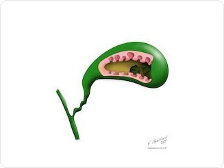 담낭선근종증